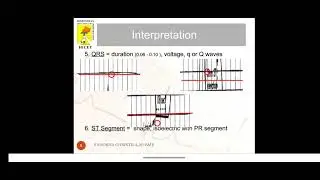 Biomedical Instrumentation - ECG Interpretation