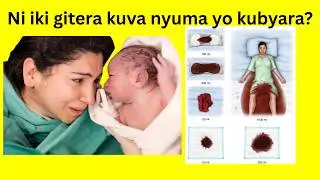 NI IKI GITERA KUVA NYUMA YO KUBYARA
