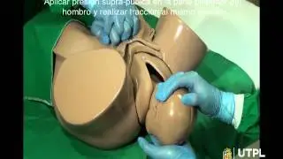 DISTOCIA DE HOMBROS