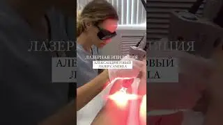 Лазерная эпиляция Candela