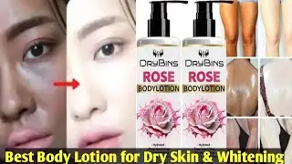 Best Whitening Body Lotion for Glowing Skin | Face & Body | Dermatologist Recommended #skincare 