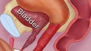 Clitoral Anatomy Overview