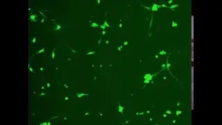 Neurite Outgrowth