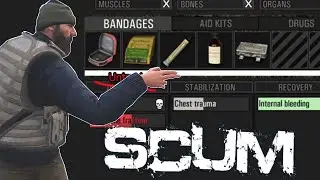 Scum News - New Healing Process, New Injuries & New Healing Items (Metabolism Info)