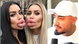 How to resign without notice period | Bartmann reactions | Bartmann videos | funny videos | comedy 🤣
