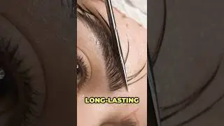 #Eyebrow #transplant #aftereffects