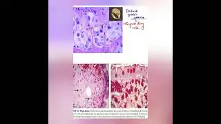 Gastric  #medical #stethoscope #microscope #biology #modi #anatomy #pathologists #aiimspg #pathology