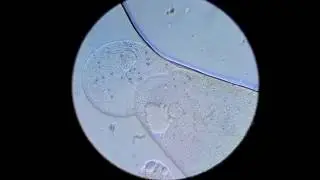 Dying Paramecium sp. under microscope 640x  - 