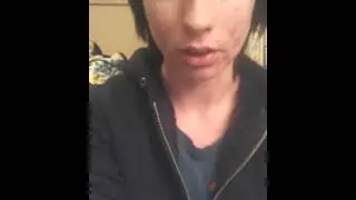 Exposed Skin Care Journey--Rowan's Story; Week 7?