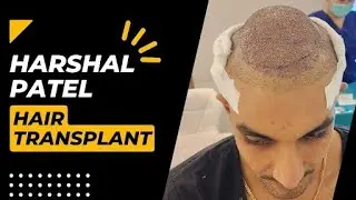 Cricketer Harshal Patel Hair Transplant - Monaris Hair Clinic