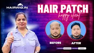 Men Hair Patch |#transformation  #gorakhpur #PinkiSingh #Hairwig #lucknow #trending #viral #hairwig