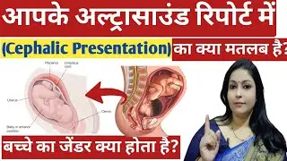 What does Cephalic Position mean? Cephalic Presentation Of Baby // Cephalic Presentation Hindi