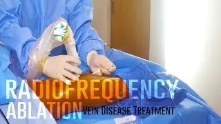 Radiofrequency Ablation | Vein Disease Treatment | Chronic Venous Insufficiency | VIP Centers