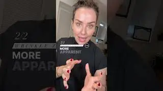 FAQ | Botox | How to keep you looking natural