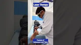 Post Fracture of Calcaneum & Talus physiotherapy |  Post Complex Ligament Injury Physiotherapy