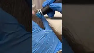 HydraFacial Keravive | Scalp Health Rejuvenation Treatment