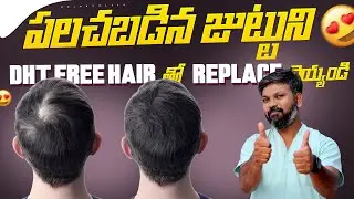 #AskDrJohnWatts | పలచబడిన జుట్టుని DHT FREE HAIR తో REPLACE చెయ్యండి | Hair Specialist Explains