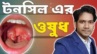 টনসিলের সমস্যা ও সমাধান | টনসিলের হোমিওপ্যাথি চিকিৎসা |
