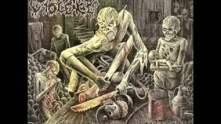 Extreme Violence - Devourment Syndrome