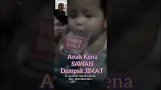 Anak Bayi Kena SAWAN #pengobatan #anak #bayi