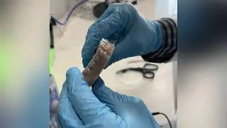 Boss Orthodontics: In-house Clear Aligner Printing and Fabrication