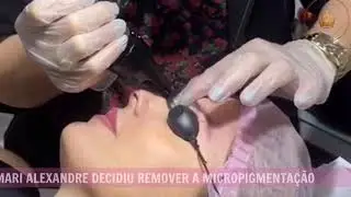 MARI ALEXANDRE REMOVENDO MICROPIGMENTA&Ccedil;&Atilde;O DA SOBRANCELHA