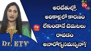 Is Sweating Palms And Soles For No Reason A Health Problem? | Dr.ETV | 16th Jan 2023 | ETV Life