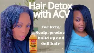 How to use ACV to detox and restore your hair| Before and After Results inside