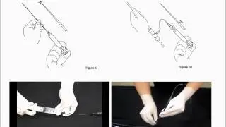 Physician reference manual EVAR of COOK Zenith AAA endovascular graft by Dr Kong joonhyukkong@empas