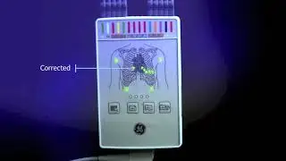 GE MAC VU360 SMART Acquisition - DEMO