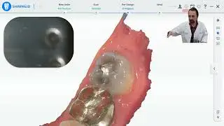 Use Your Intra Oral Scanner in Hygiene with the Aoralscan 3 IOS and the NEW ConsulOS AI Powered Tool