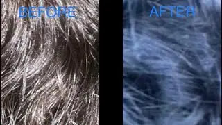 Manic Panic Shocking Blue On Brown Hair