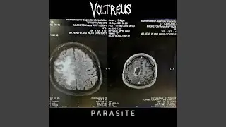 PARASiTE