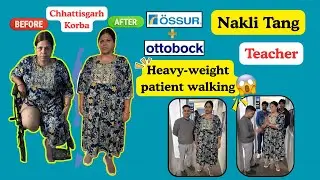 From Wheelchair to Walking | Above Knee Artificial Leg for Women | Ossur & Ottobock Prosthetic