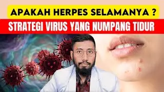 90% Orang Tak Sadar Mengidapnya! Kenali Virus Herpes & Cara dia Selamanya di tubuhmu
