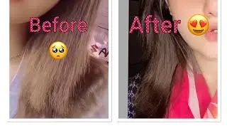Visible difference in A month ☺️