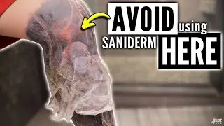 Warning: Avoid These Areas When Using Saniderm & USE This EASY Method to Remove Second Skin