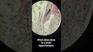 effect of rabies on brain #lab #science #lifeisbutadream #veterinary #medicine