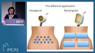 Body shaping minimal invasive approach