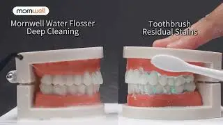 Mornwell Water Flosser Teeth Picks 4 Jets 3 Modes Portable Cordless