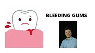 Bleeding Gums