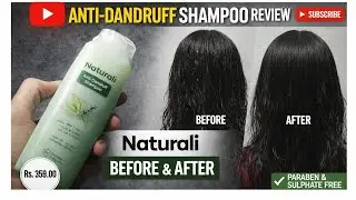 Naturali Anti-Dandruff Shampoo Review | Before & After Results | Paraben & Sulphate Free