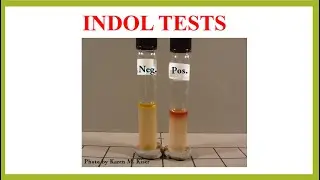 INDOL TEST | MICROBIOLOGY | IN URDU