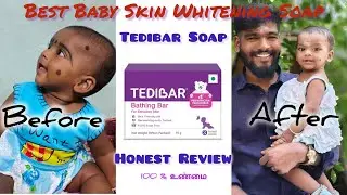 Tedibar Soap My  Honest Review| Skin whitening| Baby care|Best Soap  For all skin Type