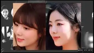 PURPLE KISS PLASTIC SURGERY ANALYSIS