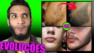 EVOLUÇÃO DOS INSCRITOS / MINOXIDIL #48
