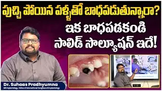 Why Do You Need Microscopic Root Canal Treatment? | Benefits of Microscope in Root Canal | Eledent