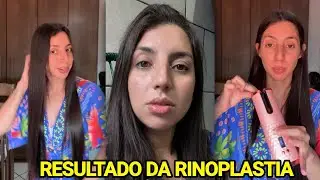 SARA KELLEN DESABAFA E MOSTRA SIMULAÇÕES DA RINOPLASTIA DO NARIZ
