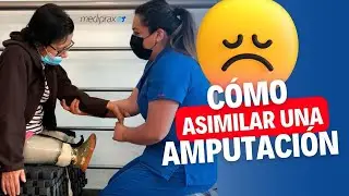 Cómo adaptarse a la pérdida de una extremidad: Aceptar los cambios físicos tras la amputación