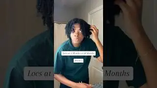 Loc Journey 🍃. 5 months vs 10 months. #locjourney #starterlocs #dreads #dreadlocks #locs